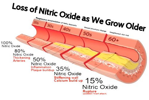 progressive loss of nitric oxide production
